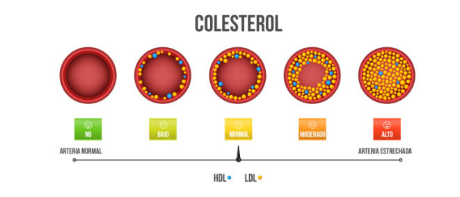 En la mayoría de los casos, el colesterol es consecuencia de una dieta poco saludable y una vida sedentaria, aunque también puede tener un origen genético.