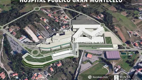 A zona de basamento distribuirase en dous edificios de 5 plantas, un dianteiro para as consultas externas e outro atr&aacute;s para as urxencias e o bloque cir&uacute;rxico, sobre os que se elevar&aacute; un terceiro edificio que albergar&aacute; a &aacute;rea de hospitalizaci&oacute;n.