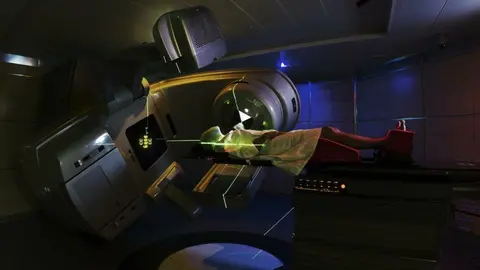 Equipo de radioterapia contra el cáncer. ARCHIVO.