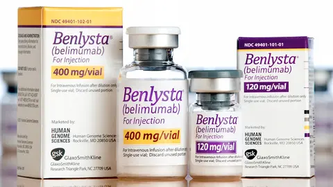 Llega a España Benlysta como tratamiento para la nefritis lúpica activa.