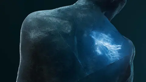 También llamada culebrilla, el herpes zóster está causado por la reactivación del virus de la varicela-zóster (VVZ), el mismo que causa la varicela2.