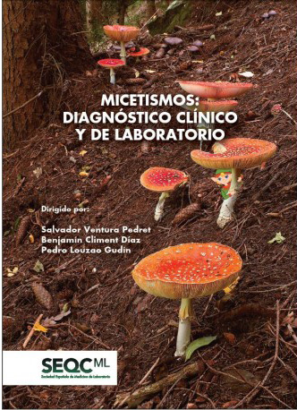 micetismos-diagnóstico-clínico-y-de-laboratorio